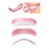 Perfect Smile - Dočasný horný zubný mostík